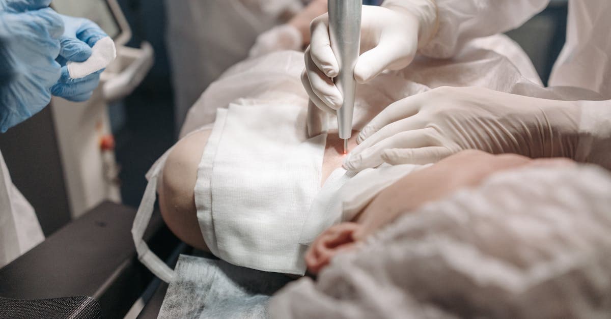 Cover image for Revitalize Your Complexion: Exploring the Benefits of Laser Skin Rejuvenation